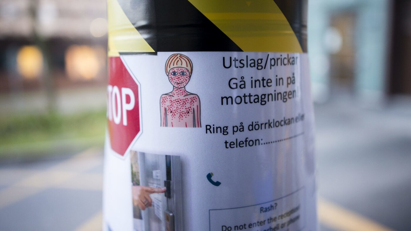 Bildet viser en plakat med informasjon om meslinger.