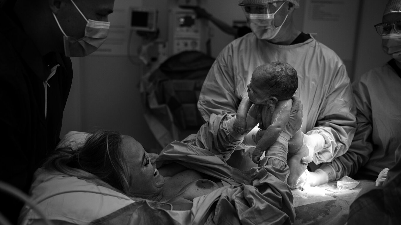 Bildet viser MAC-keisersnitt