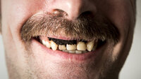 Bildet viser en mann som smiler med snus i leppa