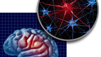 Bildet viser en illustrasjon av en hjerne med Parkinson sykdom