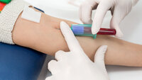 Bildet viser to  hender som tar blodprøve fra en arm.