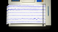 Illustrasjon av en EEG