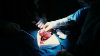 Viser nyretransplantasjon på Rikshospitalet