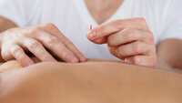 Bildet viser en pasient som får akupunkturbehandling på ryggen. I bakgrunnen skimtes en sykepleier eller akupunktør.