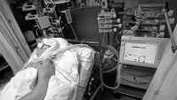 Pasient i respirator på intensivavdeling