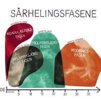 Illustrasjonen viser de fire sårhelingsfasene.