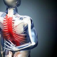 Bilde viser en illustrasjon av et skjelett med smerte i ryggen