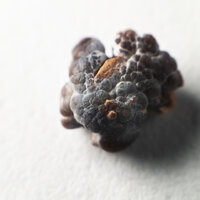 bilde av en nyrestein