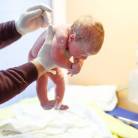 Bildet viser en nyfødt baby som løftes opp kort tid etter fødselen